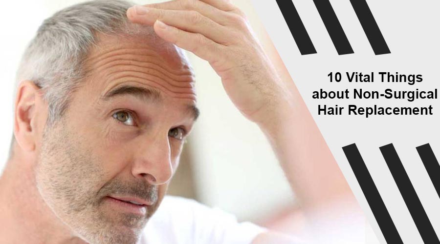 10 Vital Things about Non-Surgical Hair Replacement