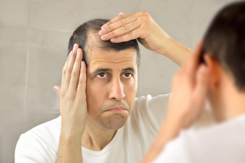 Feeling uncomfortable to deal with hair loss? Try hair fixing