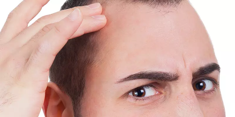 Get instant visible results for patchy baldness with hair fixing