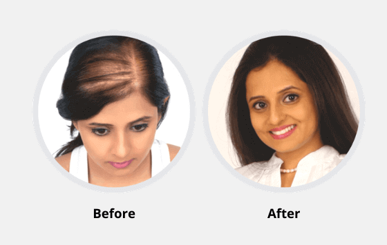Hair fixing allows you to create trending hair look without surgery