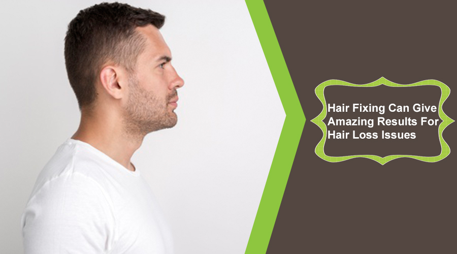 Hair Fixing Can Give Amazing Results For Hair Loss Issues 