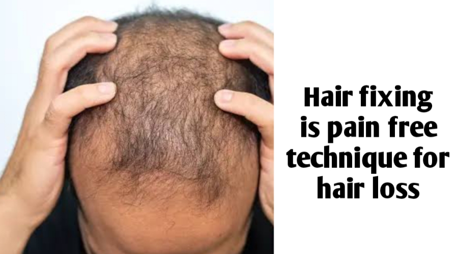 Hair fixing is pain free technique for hair loss