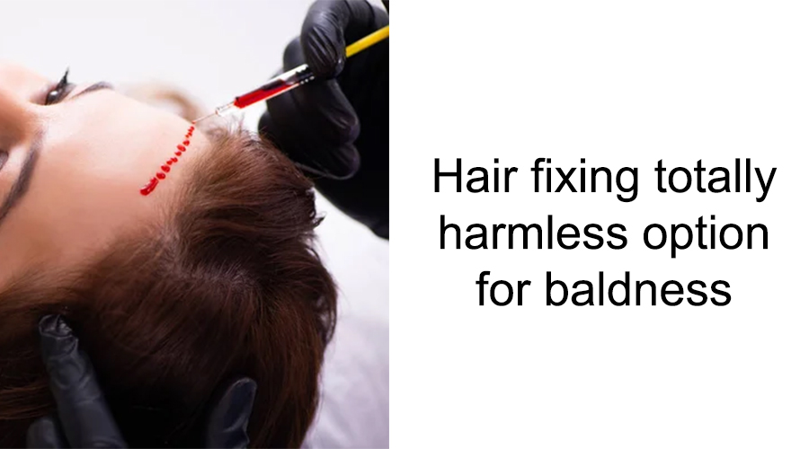 Hair fixing totally harmless option for baldness
