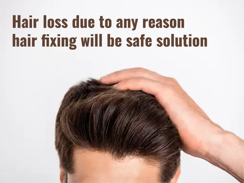Hair loss due to any reason hair fixing will be safe solution
