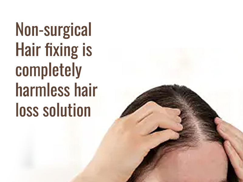 Non-surgical Hair fixing is completely harmless hair loss solution