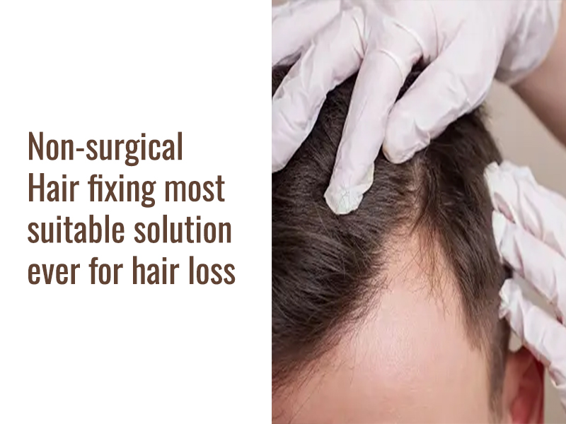 Non-surgical Hair fixing most suitable solution ever for hair loss