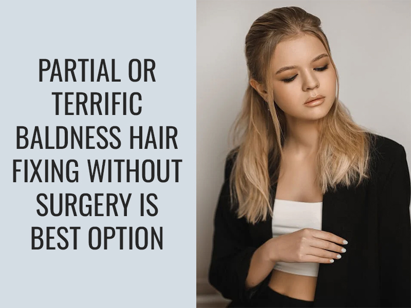 Partial or terrific baldness hair fixing without surgery is best option