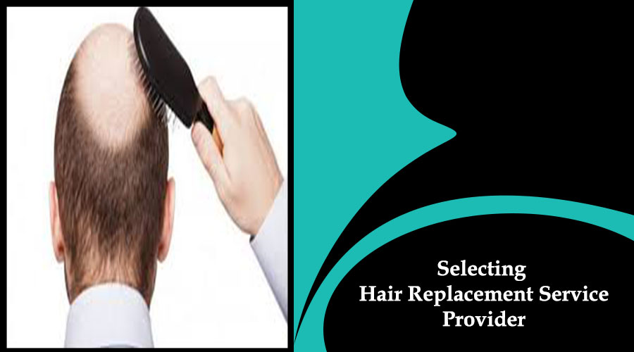 Selecting Hair Replacement Service Providers  